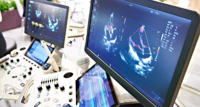 With 37% return in one year, can Nanosonics Limited (ASX NAN) deliver on FY23 guidance?