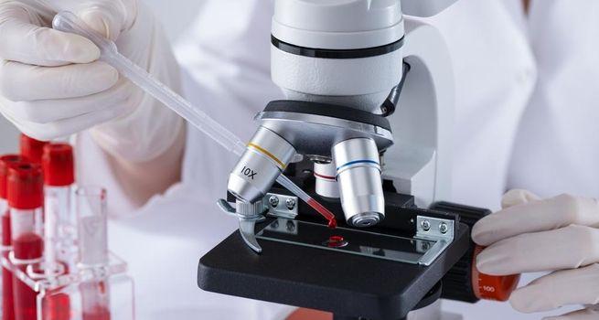 Bcal Diagnostics (ASX:BDX)-What the Latest Share Price Drop Means for Investors?