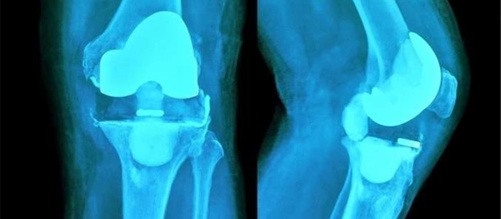 Are these 2 Healthcare stocks at higher levels - PAR, NAN