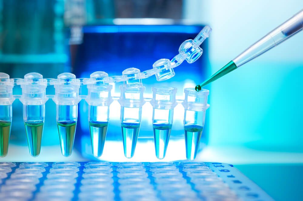 Are These Material Stocks Good to Buy or Hold- AMC, ORA