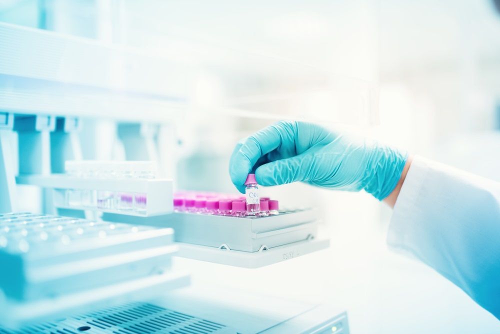 2 Upcoming Dividend Payment Stocks in October 2020- CSL, EBO