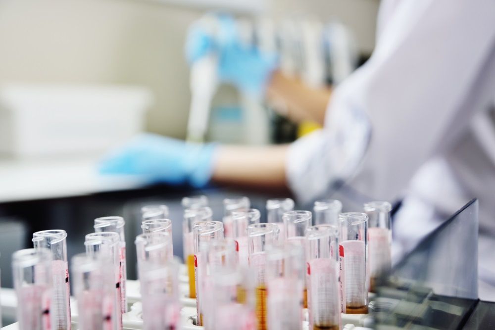 How the Needle is Moving on these Nasdaq Listed Stocks – FLGT and VLDR