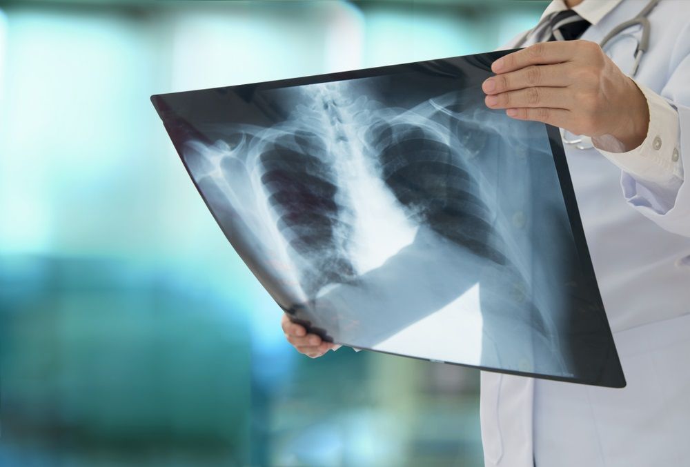 One Beaten Down Healthcare Stock to Invest- OSP