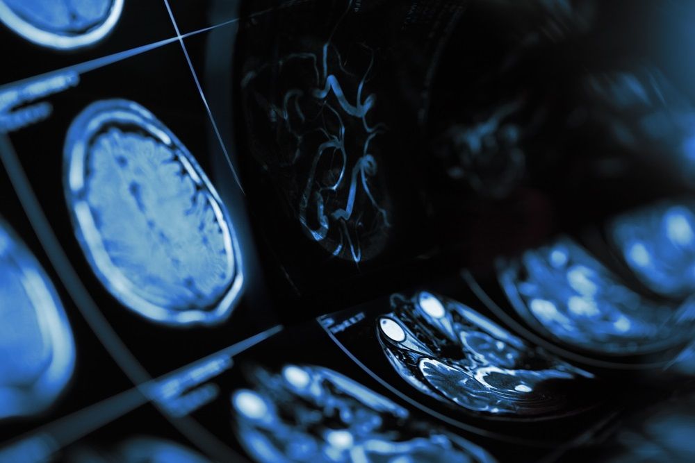 Should You Invest in this Healthcare Stock for Long-term- PME?