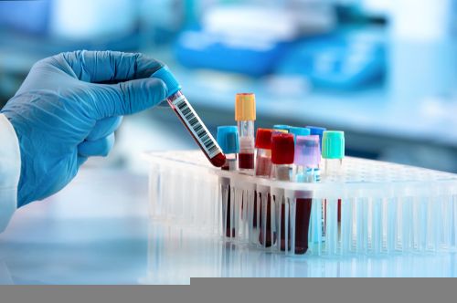 Technical Analysis on One ASX-Listed Healthcare Stock - LDX