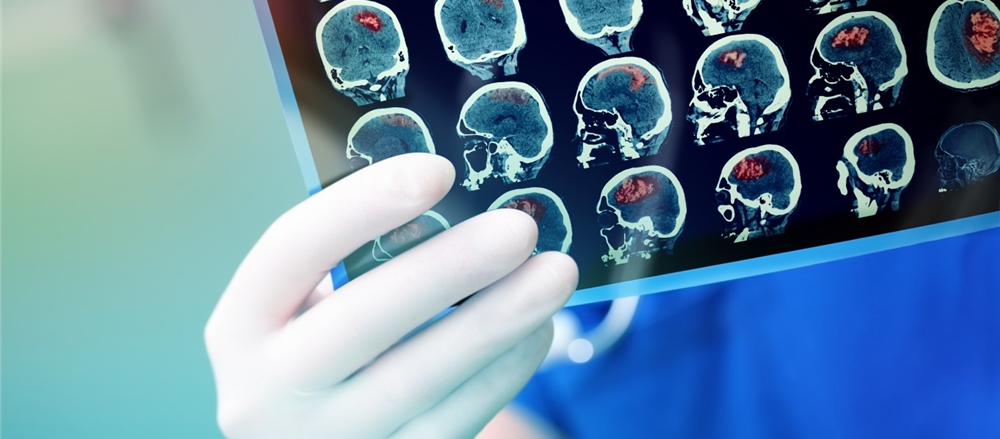 One Penny Stock to Sell – TLX 