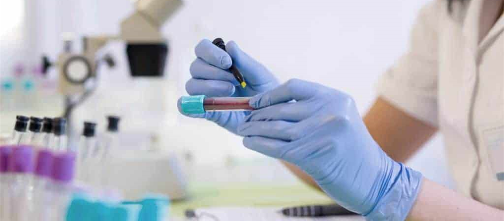 Are these 5 Stocks in buy zone - CSL, SHL, NAB, WAM, CRD